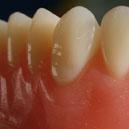 Birches Head Denture Clinic image 4