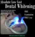 AFFORDABLE TEETH WHITENING TOOTH IMPLANTS image 4