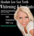 AFFORDABLE TEETH WHITENING TOOTH IMPLANTS logo