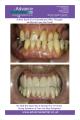Advance Dental Care image 2