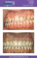 Advance Dental Care image 5