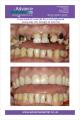 Advance Dental Care image 1