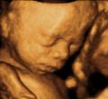 Apeekaboo Imaging 3D/4D Baby scanning image 2
