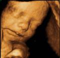 Apeekaboo Imaging 3D/4D Baby scanning image 3