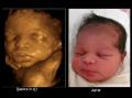 Apeekaboo Imaging 3D/4D Baby scanning image 1