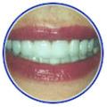 Appledore Dental Clinic Milton Keynes logo