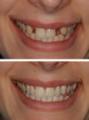 Blairgowrie Dental Care image 3