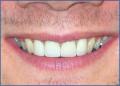 Bournemouth Dentist @ Queens Park Dental Team image 5