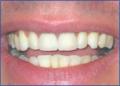 Bournemouth Dentist @ Queens Park Dental Team image 6