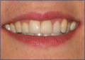 Bournemouth Dentist @ Queens Park Dental Team image 7