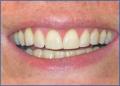 Bournemouth Dentist @ Queens Park Dental Team image 8