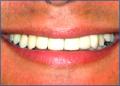 Bournemouth Dentist @ Queens Park Dental Team image 10