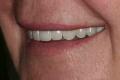 Carisbrook COSMETIC DENTIST  manchester centre image 4