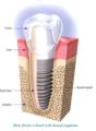 Cosmetic Dentist & Dental Implants Norwich - Dr Ori Michaeli image 6