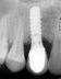 Cosmetic Dentist & Dental Implants Norwich - Dr Ori Michaeli image 9