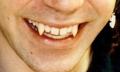 Cosmetic Denture Design, Teeth Whitening and Fangs by Speedy Denture Repairs LTD image 4