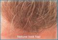 David Hough Hair Loss Consultants image 5