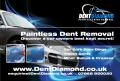 Dent Diamond - Paintless Dent Removal logo