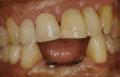 Dental Implants & Cosmetic Dentistry @ SW Smiles image 2