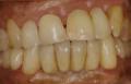 Dental Implants & Cosmetic Dentistry @ SW Smiles image 3