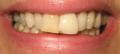 Dentist of The Year 2010,  Call today for your Perfect new Smile image 3