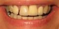 Dentist of The Year 2010,  Call today for your Perfect new Smile image 4