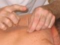 Eagle House Physiotherapy & Sports Injury Clinic with Complementary Therapies image 5
