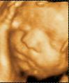 Face2Face 3D Baby Scans image 3