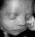 Face2Face 3D Baby Scans image 4