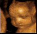 Face2Face 3D Baby Scans image 5
