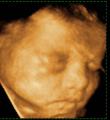 Face2Face 3D Baby Scans image 6