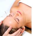 James Treacher Acupuncture and Traditional Chinese Medicine image 1