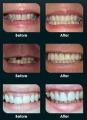 L & H Dental Care (Hamilton) image 2