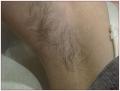 Light Fantastic IPL Laser Hair Removal Clinic image 2