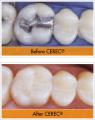 Orchid Dental Centre - Cosmetic and Implant Dentist in Brackley, Northampton image 3
