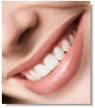 Pro Teeth Whitening Ltd image 2