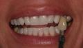 Pro Teeth Whitening Ltd image 1