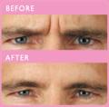 Revive non surgical cosmetic treatments image 2