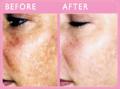 Revive non surgical cosmetic treatments image 3