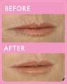 Revive non surgical cosmetic treatments image 4