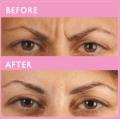Revive non surgical cosmetic treatments image 10