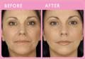 Revive non surgical cosmetic treatments image 1