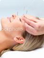 SIMPLY ACUPUNCTURE 5 Element and Traditional Chinese Medicine Leicester image 6