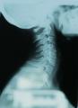 Sayer Chiropractic Back & Neck Pain Clinic: Croydon image 4