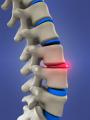 Sayer Chiropractic Back & Neck Pain Clinic: Croydon image 7
