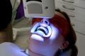 Smile Sensation UK: Affordable Teeth Whitening Middlesbrough & Darlington image 2