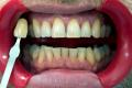 Sparkly Whites Laser Teeth Whitening Clinic image 3