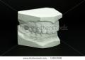 Sparkly Whites Laser Teeth Whitening Clinic image 5