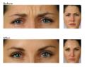 St Mellion Plymouth Laser Clinic image 8