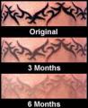 Tattoo Removal Cream logo